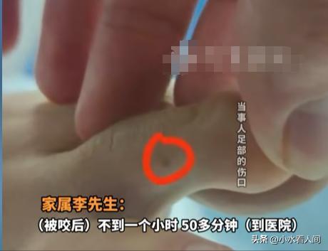 女子疑蛇咬身亡后续！伤口曝光治疗过程耽误卫健委：封档彻查(图4)