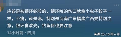 女子疑蛇咬身亡后续！伤口曝光治疗过程耽误卫健委：封档彻查(图9)